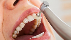 Zahnarzt poliert Zähne mit elektrischem Bürstchen